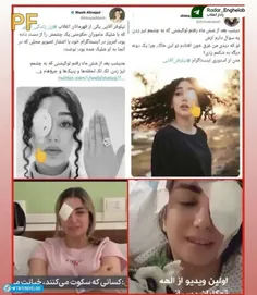 ⭕️ خانوم نیلوفر آقایی هستن که هر روز یه چشمشون خوب میشه ا