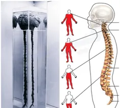 مغز و نخاع دیده بودین تا حالا؟!