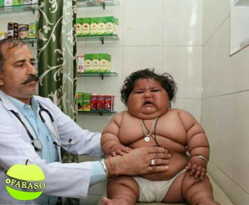این کودک هشت ماهه هندی حدود ۱۷ کیلوگرم وزن دارد