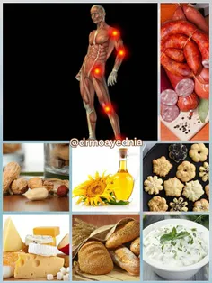 این مواد غذایی برای کسانی که مبتلا به آرتروز هستند ممنوع 