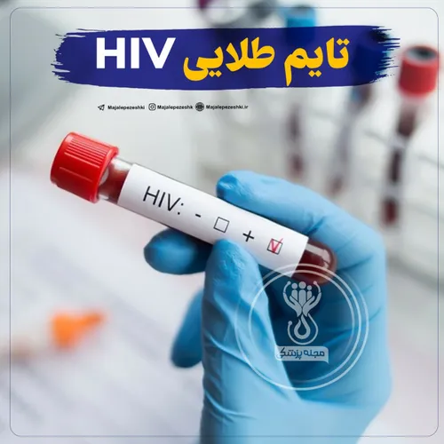 تایم طلایی HIV