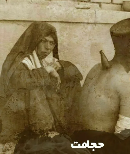 ♨️ تصویری قدیمی از نحوه "حجامت" در دوران قاجار