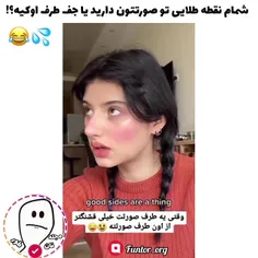 شمام نقطه طلایی دارید تو صورتتون یا جفت طرف اوکیه؟!🧐❗