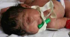 انتشار گسترده تصویر "نوزادشبیه دجال"درفضای مجازی جهان عرب