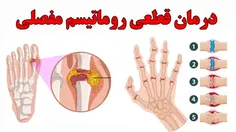 درمان قطعی التهاب مفاصل