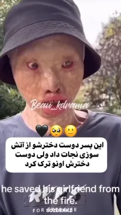 خیلی درد داره💔🤧