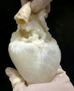 قلب انسان پس از تخلیه کامل خون !