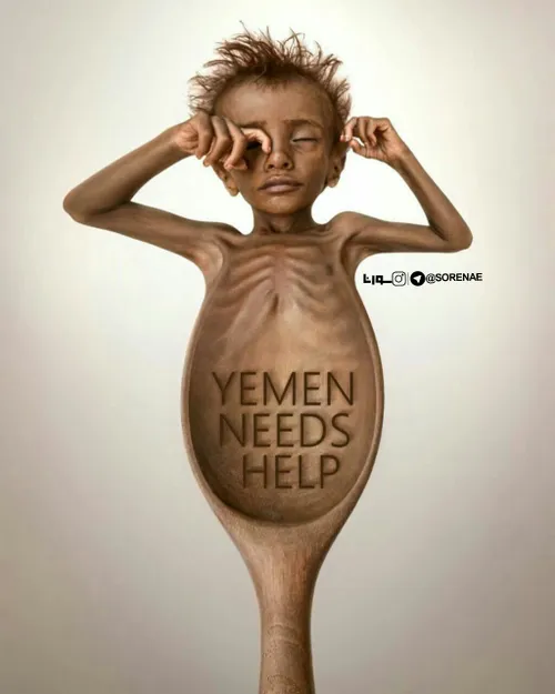 نسل کشی مردم مظلوم یمن را فراموش نکنیم.