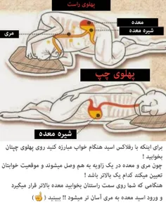 چرا خوابیدن به پهلوی راست، رفلاکس و سوزش معده را تشدید می