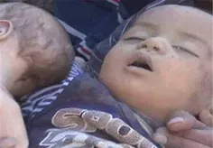 یونیسف: از ابتدای جنگ در یمن ۷۴۷ کودک کشته و ۱۱۰۸ کودک زخ