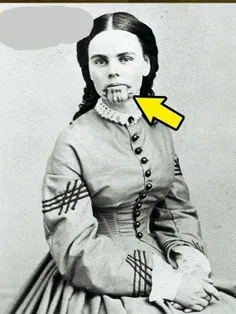 🔹تتوی  #سرخ‌پوستی روی صورت یک زن سفیدپوست در سال ۱۸۶۳ میل