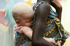 پدیده ای#عجیب و نادر در افریقا،تولد نوزادی سفید پوست و#زا