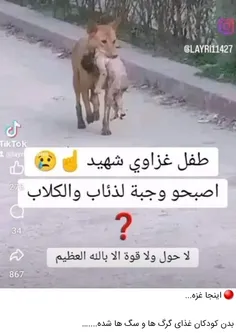 طفل شهید غزه در دهان گرگ . خدایا این همه مصیبت