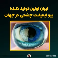 بیو ایمپلنت های چشمی ایران برای نخستین بار در جهان تولید شد🇮🇷