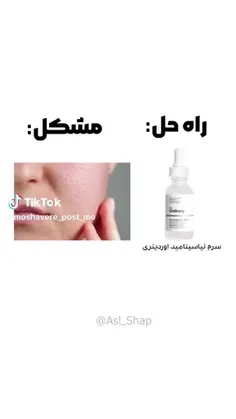 mo_jm 75554745