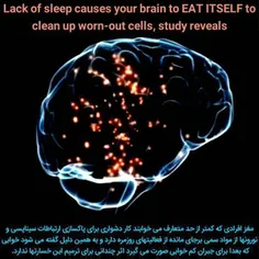 مغز هنگام بی خوابی خودش را می خورد