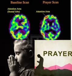 #طبق نتایج مطالعات انجام شده، دعاهای معنوی می‌توانند با ض