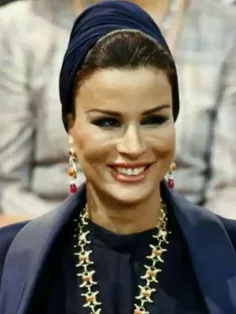 یکی از رکوردهای عمل زیبایی مربوط به "موزه" همسر سابق امیر