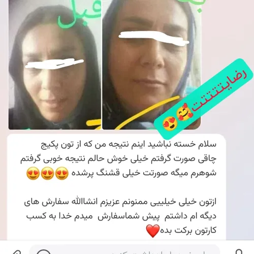 رضایت مشتری گلم از پکیج چاقی صورت خدایا شکرتتت😍😍