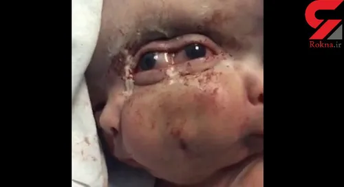 تولد نوزادی عجیب الخلقه در تهران