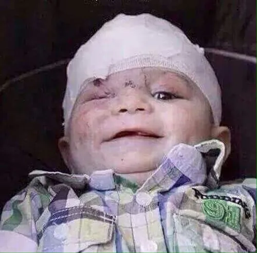 حاصل بمباران حلب توسط تروریست ها،