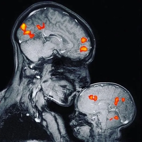 تصویر واقعی و شگفت انگیز از مغز مادرو کودک، با استفاده از