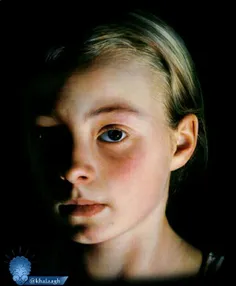 #نقاشی#هایپررئالیسم فوق العاده از Gottfried Helnwein#هنرم