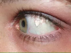 چشم دل