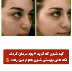 مزاجشناسی روشن هستم مشاورپوست و مو و درمانگر بیا حتما به سوی سلامت میبرمت