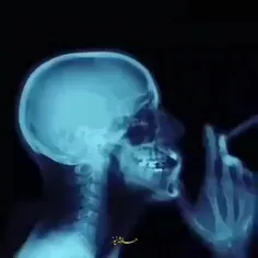 یک فرد در حال سیگار کشیدن در اسکن MRI اینگونه دیده می‌شود