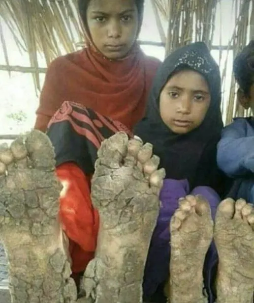 عجیب است، دختران ایرانی اگر کفش نداشته باشند کسی پیدا نمی