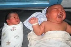 این #نوزاد 11 ماهه کلمبیایی که در حال حاضر 28 کیلوگرم وزن
