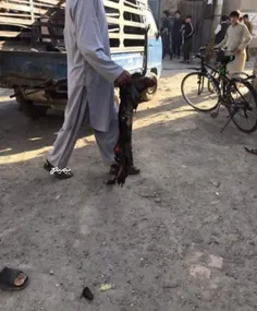 این پای یکی از دختران حادثه تروریستی کابل است 