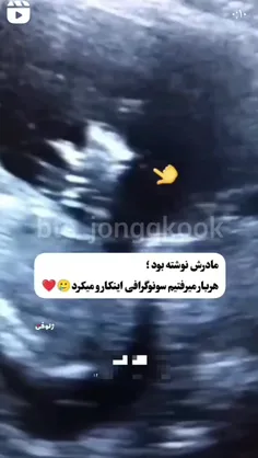 کوکی واقعا این کار را میکردی پس از بچگی رقاص بودی🤣🤣