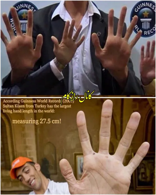 بزرگترین دست جهان به طول 28.5 سانتیمتر متعلق به سلطان کوز