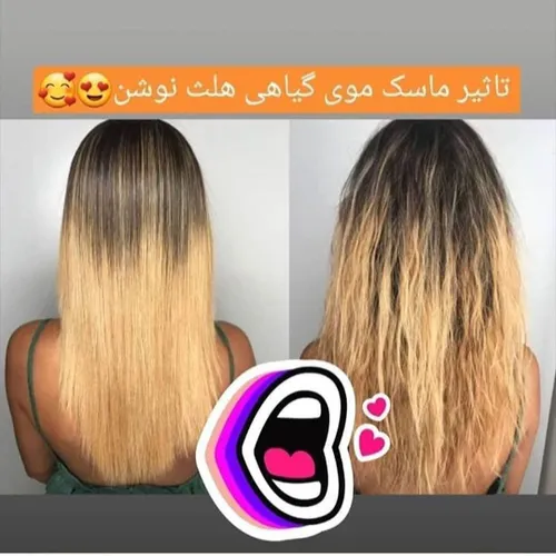 ماسک موی هلث نوشن