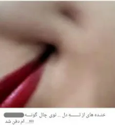 کیاچال گونه دارن?!??