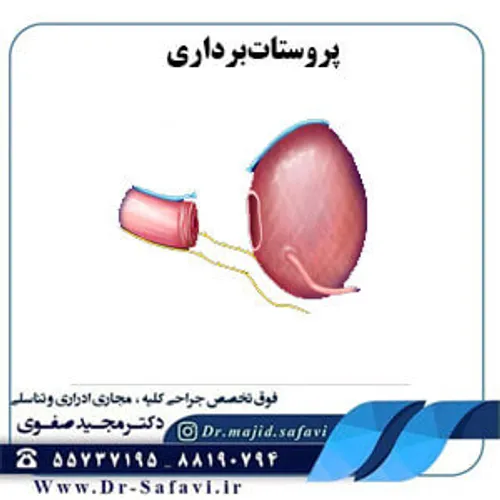 پروستات برداری یا Prostatectomy عمل جراحی است که طی آن تم