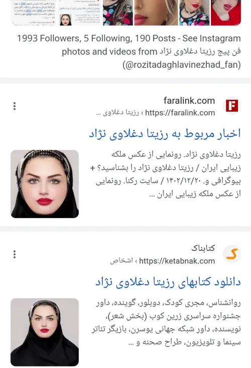 جدیدترین اخبار مربوط به ملکه زیبایی ایران رزیتا دغلاوی نژ