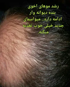 میواسما.. نه شیمیاییه نه مستقیما گیاهی.. بلکه حاصل
جذب انرژی گیاهان مختلف بشکل مغناطیسی درون راکتور
نانو پلاسماییه... این راکتور اختراع بومی هست💪💪