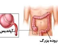 برعکس تصور اکثر مردم آپاندیس عضو اضافی و بی فایده ای نیست