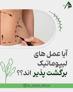 نکته مهمش تو کپشنه💕