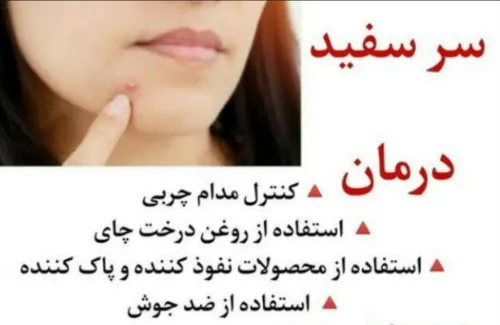 جوش سرسفید