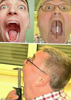 ⚡ ️رکورد بیشترین اندازه ای که یک دهان باز شده