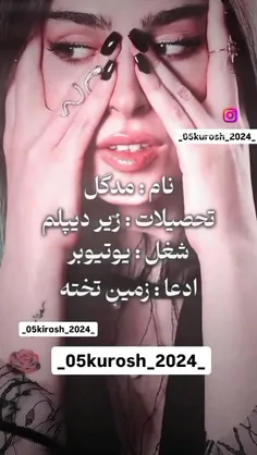 مدگل زندس😂