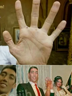 بزرگترین دست جهان به طول 27.5 سانتیمتر متعلق به سلطان کوز