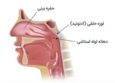 ✅سرفه و ترشح زیاد پشت حلق