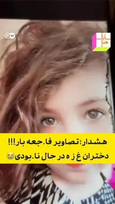 تصویر قبل و بعد کودک زیبای فلسطینی بعد از حصر غذایی