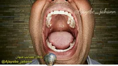 بیشترین دندان که 37 تاست در دهان کومار هندی قرار دارد که 