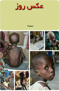تصاویر هولناک از کودکان گرسنه نیجریه 